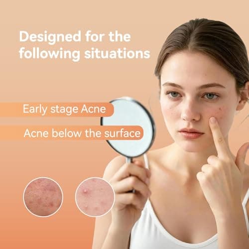 OmaDoto Microdart Pimple Patches for face - 6 Count - Micropoint with Salicylic Acid - Translucent Hydrocolloid Blemish Covers & Hydrocolloid Circles - Thumbnail 5