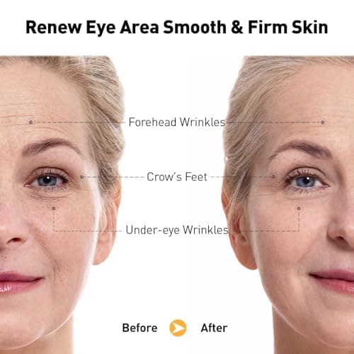 Retinol Eye Cream for Anti-Aging & Wrinkles – Firming, Hydrating & Repairing Eye Serum with Niacinamide, Hyaluronic Acid, Vitamin E & Bifida Ferment Lysate, 0.7 Fl Oz (Pack of 2) - Thumbnail 3