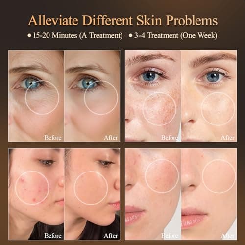 MEGELIN 7 Colors Led Light Therapy Facial Mask, Face Light Therapy Mask for Face, Reduce Wrinkles Smooth Skin, Infrared Light Skin Rejuvenation(White) - Thumbnail 5