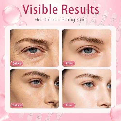 Salmon DNA Serum, PDRN Serum Ampoule for Face, Recombinant Collagen, Hyaluronic Acid, Skin Care For Deep Hydration, Moisturizing, Anti Aging, Firming & Uneven Skin Tone, 0.05 Fl.Oz x 30e - Thumbnail 5