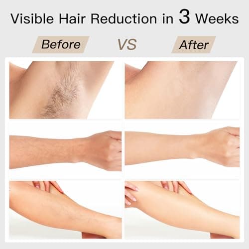 Laser Hair Removal, BoSidin IPL Hair Removal with Painless Ice-Cooling, 2-in-1 Face SR Rejuvenation, 6+1 Modes, 6 Levels Hair Removal for Women Permanent, Laser Hair Removal Kit with Shaver, Goggles - Thumbnail 3