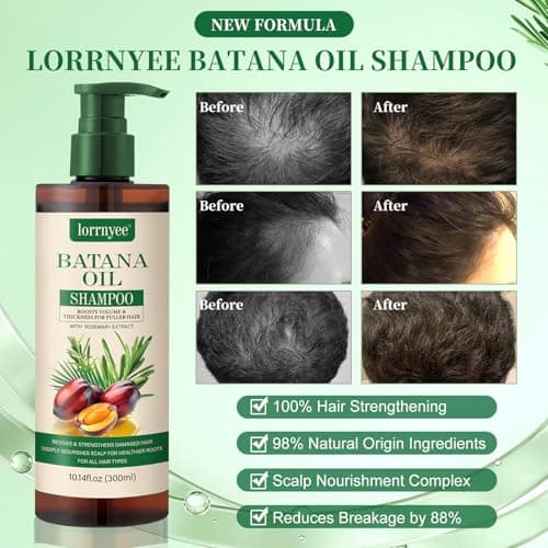 Lorrnyee Batana Oil Shampoo, Hair Growth Shampoo for Thinning Hair & Hair Loss Treatment - Organic Rosemary, Formula with Biotin & Keratin to Reduce Shedding, Thicken Hair For Men & Women10.1oz - Thumbnail 3