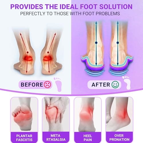 Heavy Duty Support Pain Relief Insoles, 220+ lbs Plantar Fasciitis High Arch Support Inserts, Flat Feet, Heel Pain, Work Boots Insoles for Men & Women, Shock Absorb in Every Step Purple (M 10-10.5) - Thumbnail 5