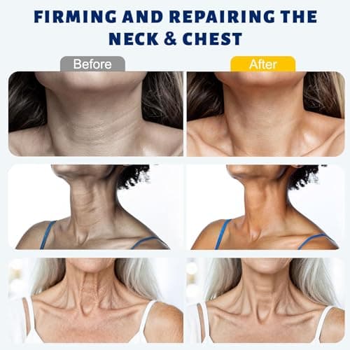 Z:SEA Neck Firming Cream with Roller 2 Pack, Anti-Aging Neck & Chest Cream with Multi Peptide + Collagen + Hyaluronic Acid + Ceramide, Pro-Xylane, Panthenol, Smooths Wrinkles & Fine Lines3.52 FL OZ) - Thumbnail 2