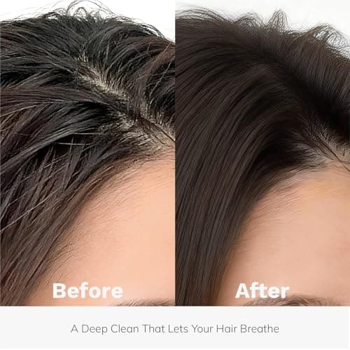 DORPANG Restore Shampoo for Thinning Hair, Peptide Shampoo for Women & Men with AnaGain™, Clinically Formulated to Support Thicker, Fuller-Looking Hair & Scalp Balance, Sulfate-Free, 12 fl oz (355ml) - Thumbnail 3