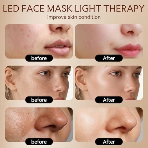 Red Light Therapy Mask for Face, 4D LED Light Therapy Mask, 4 ModesWireless LED Face Mask Light Therapy with Red Blue Light, Light Therapy Mask for Home & Travel, Skincare Gifts for Women Mom Wife - Thumbnail 3