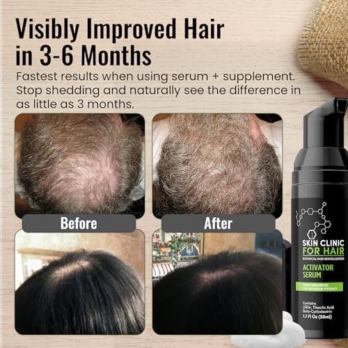 Botanical Hair Loss Foaming Serum for Thicker, Fuller Hair - Safe & Natural Formula with Saw Palmetto - Clinically-Proven for Men & Women to Improve Hair Density - By Skin Clinic for Hair - USA Made - Thumbnail 2