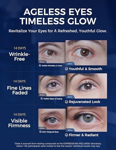 EXPRESSIONS WELLNESS Eye Cream Anti Aging for Wrinkles & Dark Circles, Korean Under Eye Cream with Peptides & Niacinamide, Firming Eye Cream for Puffiness for Women & Men 1.06 Oz Gold - Thumbnail 3