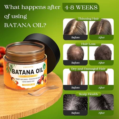 GREEONIL Batana Oil for Hair Growth, 100% Unrefined, Organic and Natural Dr Sebi Raw Batana Oil for Men Women, Prevents Hair Loss, Eliminate Frizzy, Damaged and Split Ends, 5.3 Oz - Thumbnail 2