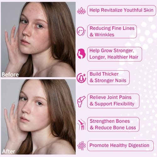 NutraNourish Multi Collagen Peptides Powder, 2LB | (Type I, II, III, V, X) with HyaluronicAcid, Biotin & Vitamin C,Supports Hair, Skin & Joint Health,Unflavored - Thumbnail 3