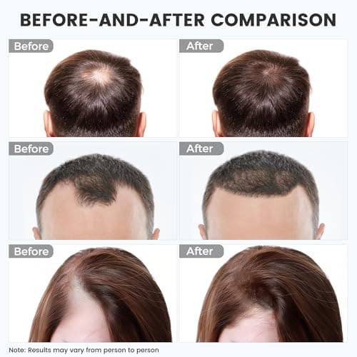 Red Light Therapy for Hair Growth: Cordless Red Light Heating Cap with 2000mAh Rechargeable Battery, Portable Care Tool for Home Use for Men & Women - Thumbnail 2