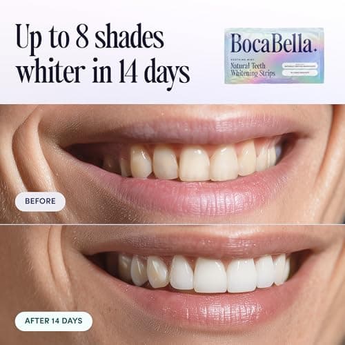 Natural Teeth Whitening Strips – Peroxide-Free, Enamel-Safe & Sensitivity-Free | 7 Treatments | Papaya & Pineapple Enzymes + Coconut Oil | Gentle Daily Stain Removal for a Brighter, Whiter Smile - Thumbnail 4