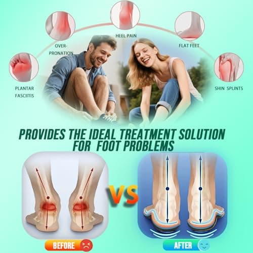 AOBEKOS Plantar Fasciitis Relief Insoles Men Women High Arch Support Shoe Inserts,240+lbs Comfort EVA Orthotics Insert Absorb Shock Work Boot Shoe Insole for Flat Feet, Pronation, Heel & Foot Pain - Thumbnail 2