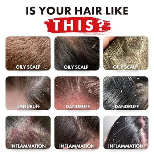 ALFHEIM Rosemary+ Purifying Shampoo for Oily & Fine Hair with Rosemary, Peppermint & Jojoba Oils – Travel Size – Deep Cleanse, Balance & Refresh – Vegan, Sulfate-Free, Cruelty-Free – 10.7 oz / 316 ml - Thumbnail 2