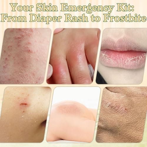 Whipped Beef Tallow Balm for Skin - 100% Organic Grass-Fed Tallow & Honey Body Butter, Infused with Olive Oil to Nourish, Soothe & Repair Dry, Cracked, Sensitive Skin- Natural Deep Moisturizer 4 OZ - Thumbnail 5