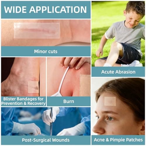 Hydrocolloid Roll for Wound Care, Hydrocolloid Bandages with Self-Adhesive, Cut-to-Size Patch Bandages, Ultra Absorbent, First Aid Kit Essential (2IN X 16FT) - Thumbnail 4