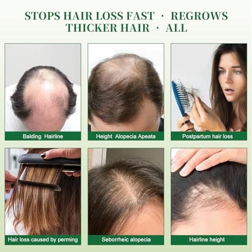 Lorrnyee Batana Oil Shampoo, Hair Growth Shampoo for Thinning Hair & Hair Loss Treatment - Organic Rosemary, Formula with Biotin & Keratin to Reduce Shedding, Thicken Hair For Men & Women10.1oz - Thumbnail 6