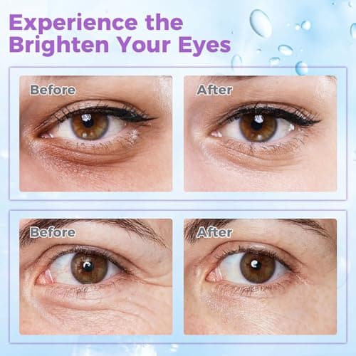 Eye Cream for Dark Circles & Puffiness – Revitalizing Formula with Retinol, Hyaluronic Acid, Caffeine, Peptides & Plant Extracts to Smooth Fine Lines - Thumbnail 3