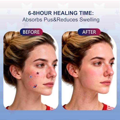 OMADOTO Star Pimple Patches for Face - 72Pcs (14mm) Hydrocolloid Acne Patches For Sports&Gatherings, USA Stars Themed Blemish & Zit Stickers, USA Party Pimple patches, 4th of July Zit Patches - Thumbnail 3