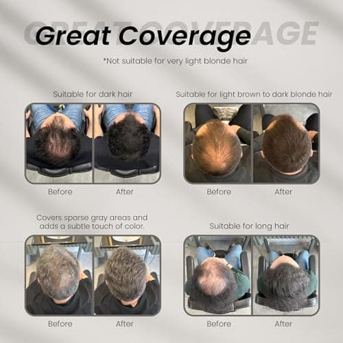 Batcı Hair Concealer & Filling Cream for Bald Spots & Thinning Hair – Waterproof, Sweat-Proof Scalp Coverage – Natural Root Touch-Up Cream for Men & Women – 1.69 Fl Oz 50 ml - Thumbnail 3