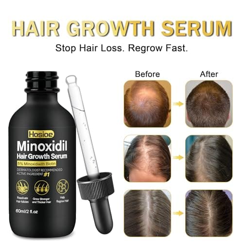 Minoxidil Hair Growth Serum (2oz) 5% Minoxidil for Men and Women Hair Growth Treatment,Topical Minoxidil for Beard Growth - Thumbnail 2