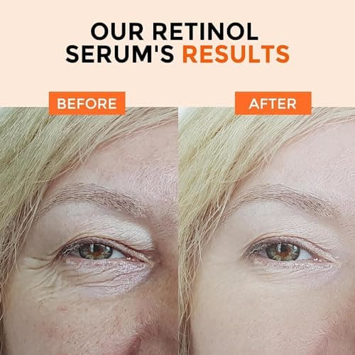 +1Herolabs Face Serum Set – Retinol Serum & Hyaluronic Acid for Face – Anti Aging Skin Care Set for Women – Firm, Wrinkle Smoothing - Thumbnail 6