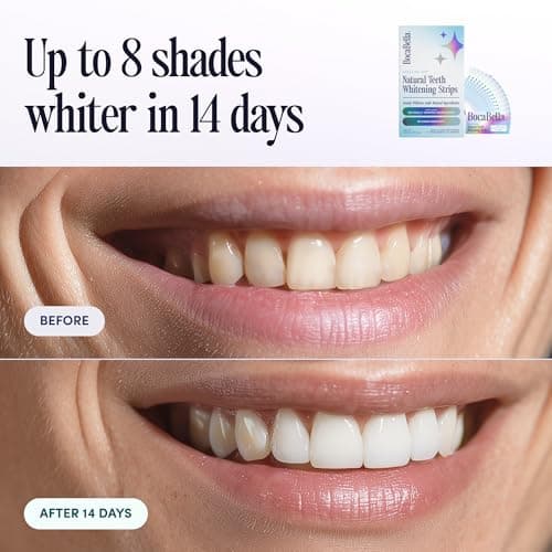 Teeth Whitening Strips for Sensitive Teeth – Natural, Peroxide-Free & Enamel-Safe | Clinically Tested Papaya & Pineapple Enzymes + Aloe & Coconut Oil | 14 Treatments for a Brighter, Whiter Smile - Thumbnail 4