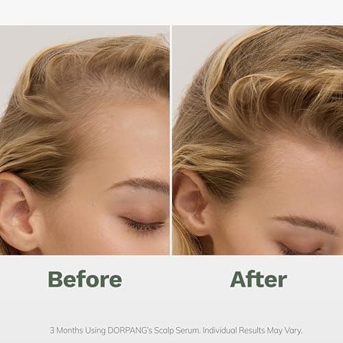 DORPANG Scalp Serum for Thinning Hair, Clinically Tested Vegan Formula with Capixyl and AnaGain, Promotes Fuller-Looking Hair & Healthy Scalp, Peptide Non-Greasy for Dry Sensitive Scalps 60ml - Thumbnail 3