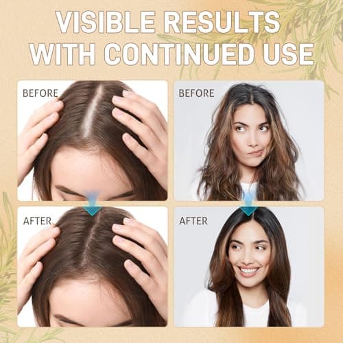Rice Water Hair Growth Serum - Infused with Rosemary, Biotin, Caffeine, Non-Greasy Formula for Hair Loss, Damaged & Dry Hair, Thicker, Longer, Fuller Hair (3.38 OZ(Upgrade)) - Thumbnail 5