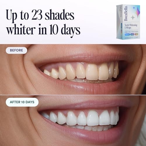 Boca Bella Teeth Whitening U-Wraps – 10 Treatments – 15% Hydrogen Peroxide, Enamel-Safe, No Harsh Sensitivity – Patented Strip Design with Aloe, Calendula & Peppermint – Fast, Even Whitening - Thumbnail 4