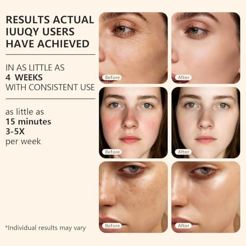 IUUQY 4-Color Red Light Therapy for Face, 400 LED Red Light Therapy Mas with Timing Function, Portable Led Face Mask Light Therapy for Home & Travel - Thumbnail 4